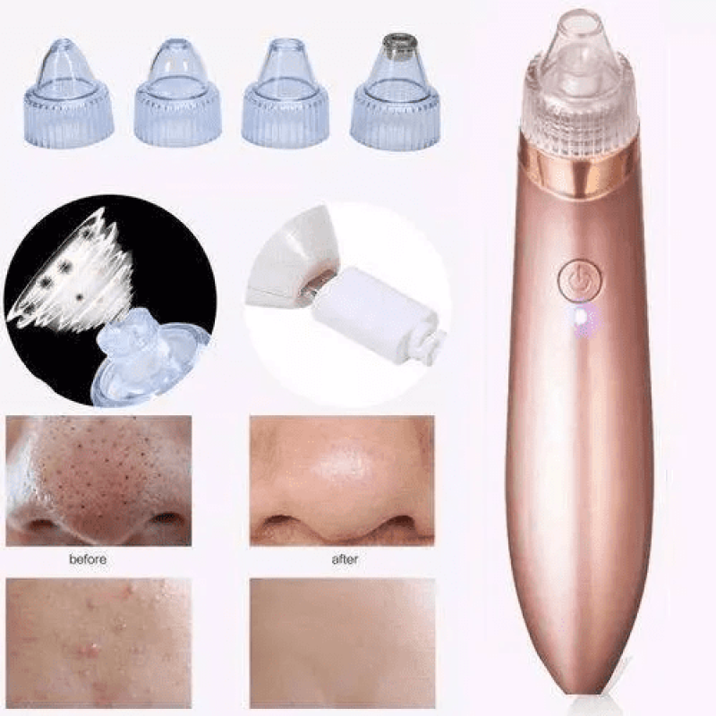 [Oferta ?] Removedor de Cravos Espinhas e Acnes NX -8030 Sugador a Vácuo